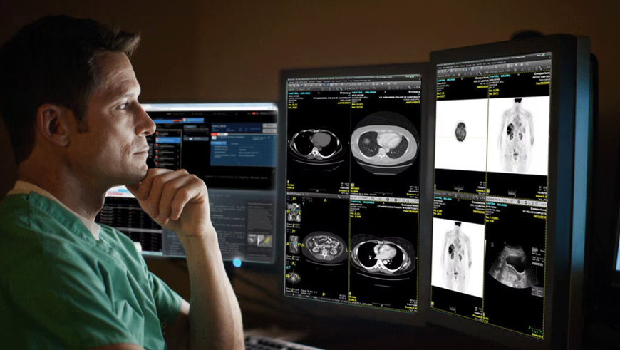 GE HEALTHCARE ACCELERATES ARTIFICIAL INTELLIGENCE ADOPTION WITH NEW OFFERING